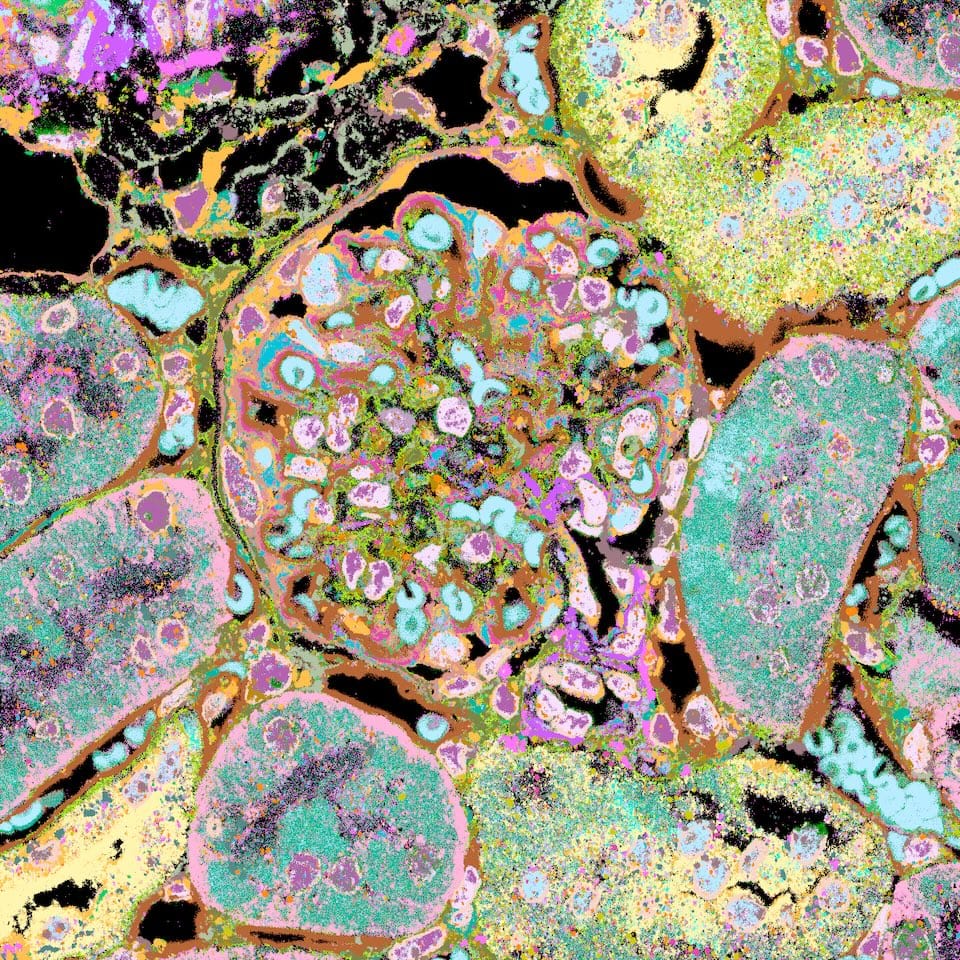 A clustered image of a glomerulus